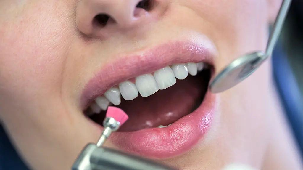 igiene e profilassi dentale
